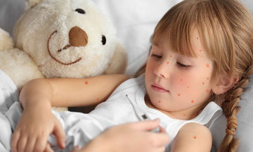 Oχ, έβγαλε σπυράκια!